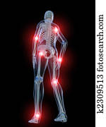inflamed joints inflamed joints