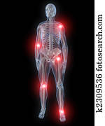 inflamed joints inflamed joints