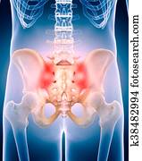 the painful hip the painful hip
