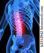 painful spine painful spine