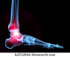 כואב, קרסול