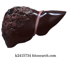liver cancer liver cancer