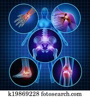 Painful Joints