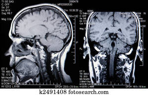 Real MRI Scans of the Head and Brain