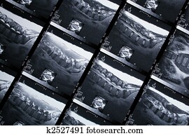x ray x ray