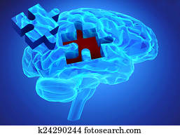 dementia, νόσος, και, ένα, απώλεια, από, εγκέφαλοs, λειτουργία, και, memories