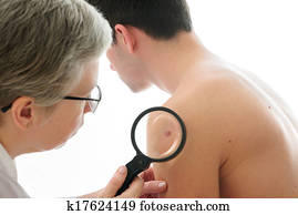 hautarzt, untersucht, a, maulwurf