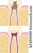 Tooth illustration Tooth illustration