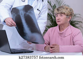Doctor showing patient chest x-ray
