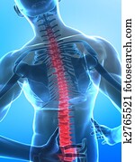 Pain in spine Pain in spine