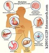 αρσενικό, αλκοολισμός