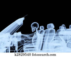 スケルトン 自動車 傷害 イラスト K Fotosearch