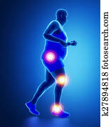Fat man joint issue Fat man joint issue