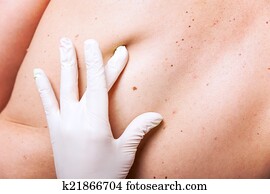 pele, exame, de, toupeiras