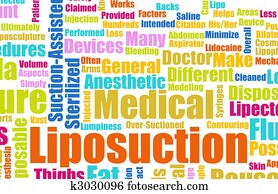 Liposuction Liposuction