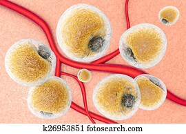 Fat Cells on human tissue Fat Cells on human tissue