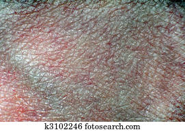 Rough vein skin texture