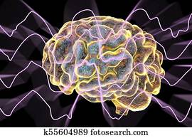 EEG Electroencephalogram, brain wave in deep sleep EEG Electroencephalogram, brain wave in deep sleep