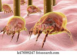 Dust mite Dermatophagoides which lives in dust and furniture Dust mite Dermatophagoides which lives in dust and furniture