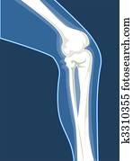 Bones