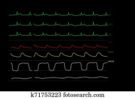 現代 心電図 モニター イラスト 136 現代 心電図 モニター 画像 Fotosearch