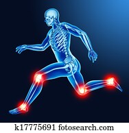 רגל, מפרק, כאב