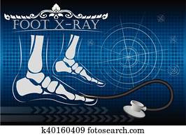 רנטגן של רגל