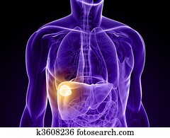 liver cancer liver cancer