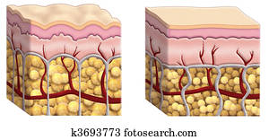 cellulite cross section cellulite cross section