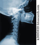 raio x, de, a, pescoço