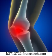 Knee Pain Knee Pain