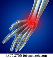 Knee Pain Knee Pain