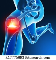 רגל, מפרק, כאב