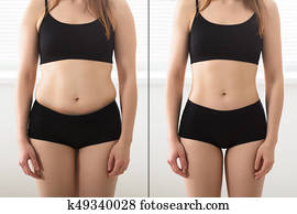 Before And After Diet Concept Before And After Diet Concept