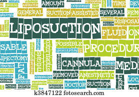Liposuction Liposuction