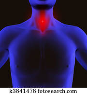 Sore throat Sore throat