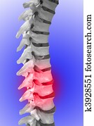Human Spinal-column, showing red for pain Human Spinal-column, showing red for pain