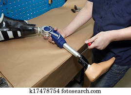 A technician adjusts a prosthetic foot. A technician adjusts a prosthetic foot.