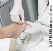 Pedicure treatment Pedicure treatment