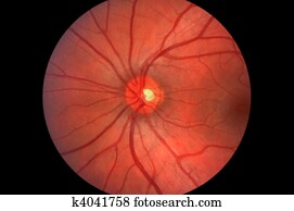 Retina