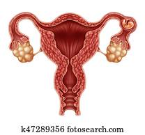 Ectopic Pregnancy Ectopic Pregnancy