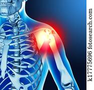 חמש, מפרק, כאב