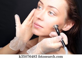 microdermabrasion microdermabrasion