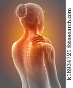 Neck pain Neck pain