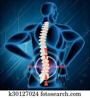 Spine bone showing back pain Spine bone showing back pain