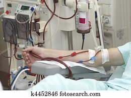 dialysis, تهتم صحة, داوى, ضرب