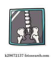 רנטגן, עצם, צבע, שרבט