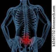 Back pain Back pain