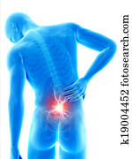 Backache Backache