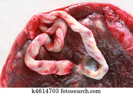 Human placenta